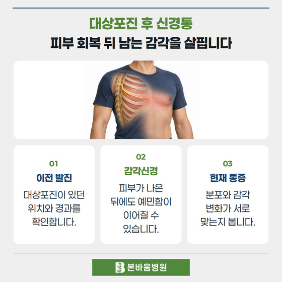 은평구신경외과 몸통 피부와 감각신경 그림 — 대상포진 후 신경통 · 피부 회복 뒤 남는 감각을 살핍니다