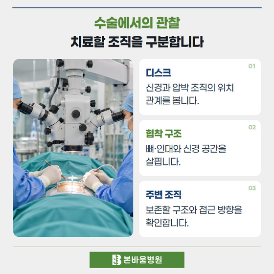 은평구신경외과 수술현미경 관찰 장면 — 수술에서의 관찰 · 치료할 조직을 구분합니다