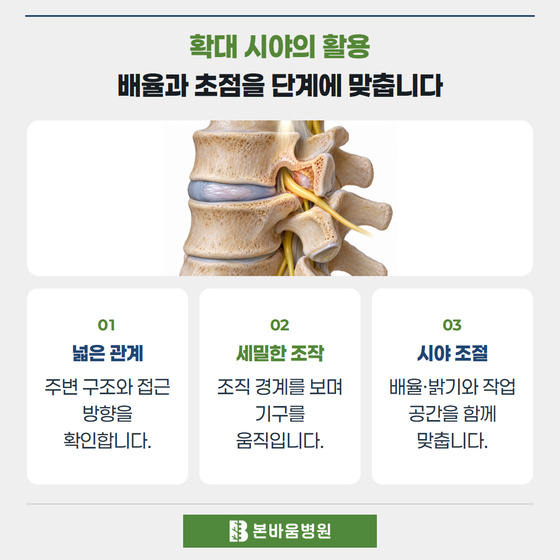 은평구신경외과 디스크와 신경의 관계 그림 — 확대 시야의 활용 · 배율과 초점을 단계에 맞춥니다