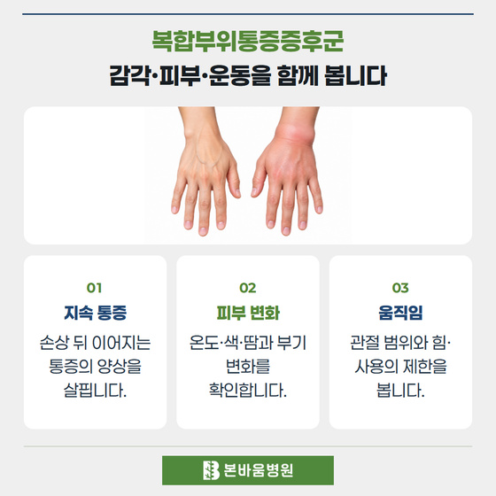 은평구신경외과 부기와 색 변화가 있는 손의 비교 — 복합부위통증증후군 · 감각·피부·운동을 함께 봅니다