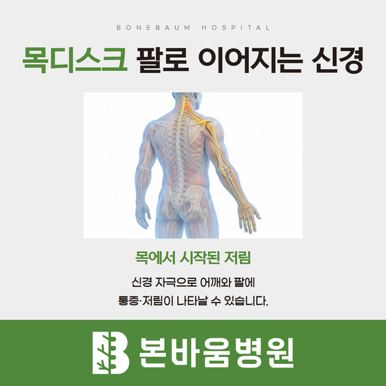 목에서 어깨와 팔로 이어지는 신경 경로를 나타낸 인체 설명 그림