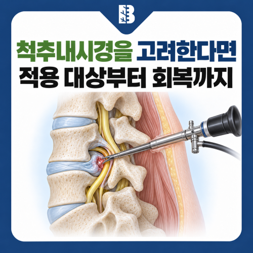 은평구신경외과 척추내시경 신경 압박을 줄이는 수술과 회복 과정