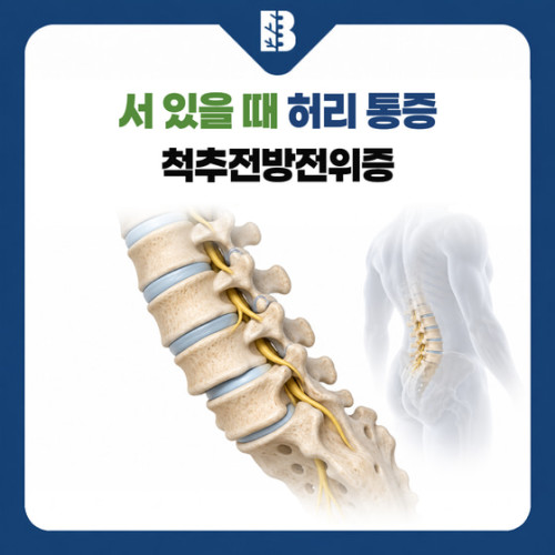 은평구신경외과 척추전방전위증, 설거지할 때 허리와 다리가 불편하다면